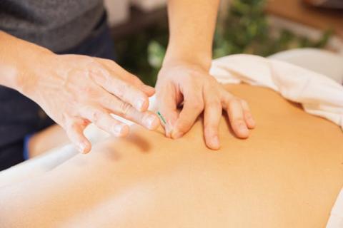 Is Acupuncture the Right Choice for You?